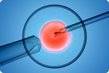 intrauterine-insemination