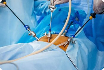 Laparoscopy / Hysteroscopy